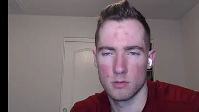 rawdawgrex online show from March 2026 07:16:02 AM